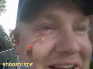 Fisherman Tries To Remove Stuck Fishhook From His Eye