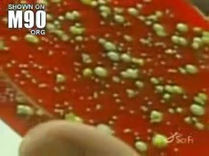 Nasty fungus eats off mans face