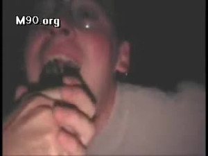 Tooth extraction...LIVE