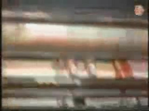 Hand caught in machine!